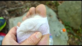 Blister Prevention on the Trail [upl. by Zwart]