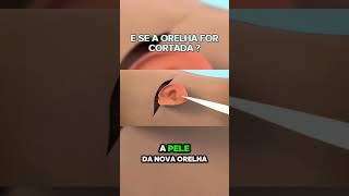 TRANSPLANTE DE ORELHA A REVOLUÇÃO MÉDICA QUE VOCÊ PRECISA CONHECER 👂🔄 curiosidades interessante [upl. by Tasiana]