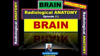 Radiological anatomy episode 1 BRAIN [upl. by Eart]