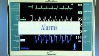 IntraAortic Balloon Catheter Tutorial English [upl. by Serg]