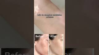 Peel the dead skin off with chemical exfoliation at home shortfeed shortvideo expolrepage yt [upl. by Nnyllaf]