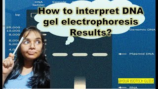 How to interpret DNA agarose gel electrophoresis result [upl. by Stinky973]