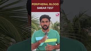 PBS  Peripheral Blood Smear Test bloodtest size shape anemia medicaltest [upl. by Packer]