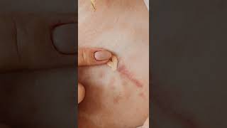 Identifying Common Skin Rashes and How to Treat Them [upl. by Sualk539]