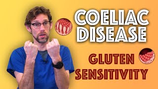 Coeliac Disease Explained  Gluten Sensitivity  A to Z of the NHS  Dr Gill [upl. by Effy488]