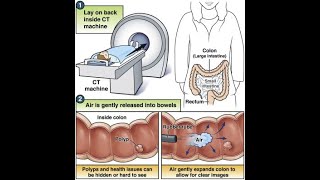 CT Colonography CT scan abdomen [upl. by Favata11]