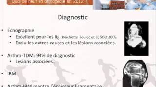 Ligamentoplastie cheville clinique du sport Dr CORDIER [upl. by Aehsrop255]