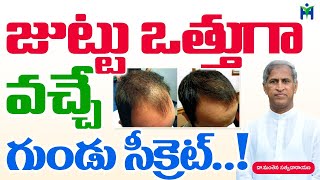 జుట్టు ఒత్తుగా పెరిగే గుండు టెక్నిక్ Hair Growth Manthena Satyanarayana Raju Videos HealthMantra [upl. by Ahsinut]