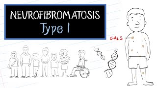 What is Neurofibromatosis Type 1 NF1 [upl. by Eiramlirpa833]