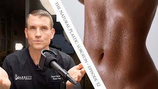 32 Everything You Need To Know About Liposuction [upl. by Primo]