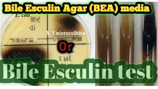 Bile Esculin Agar or Bile Esculin test culture media lecture 28 [upl. by Alhahs]