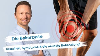 Bakerzyste  Die neueste Behandlungsmethode [upl. by Hadrian461]