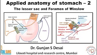 Lesser sac and foramen of Winslow  Applied anatomy of stomach part 2 [upl. by Yob]