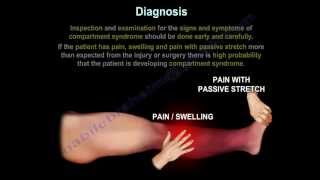 Compartment SyndromeDiagnosisPressuresFasciotomy Everything You Need To Know Dr Nabil Ebraheim [upl. by Yemirej]