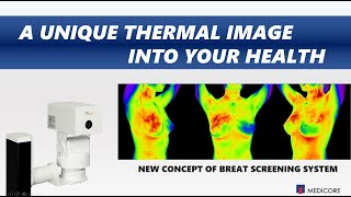 IRISXP Infrared Thermography Imaging System For Medical Use [upl. by Oberheim862]