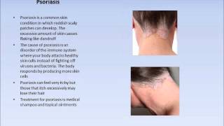 What Are Common Causes Of A Sore Scalp [upl. by Nohshan151]