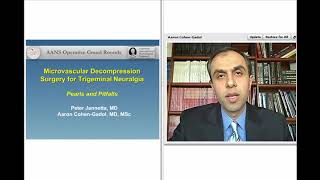 Microvascular Decompression Surgery for Trigeminal Neuralgia Preview [upl. by Oine]