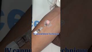 Intravenous cannula method  IV cannulation technique procedure amp Practical [upl. by Rramal]