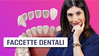 Faccette dentali [upl. by Maxia]