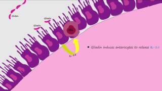 Celiac Disease Pathogenesis Described Concisely and in Detail [upl. by Lielos131]