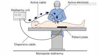 How diathermy works [upl. by Aphra]