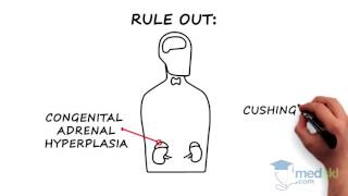 Endocrinology  Hirsutism and Hypertrichosis By Joshua Lakoff MD [upl. by Eloccin]