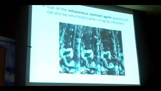 Pyogenic Spine Infections Dr Fady Michael [upl. by Romanas844]