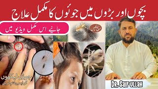 Sar Ki Juen Khatam Karne Ka Tarika  Head Lice Removal  Lice In Hair Symptoms Causes And Treatment [upl. by Neirbo200]