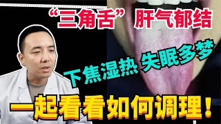 “三角舌”肝气郁结，下焦湿热 失眠多梦，一起看看如何调理！ [upl. by Ahsinrad]