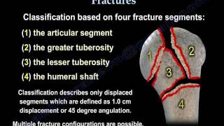 Proximal Humerus Fractures classification  Everything You Need To Know  Dr Nabil Ebraheim [upl. by Oniotna]