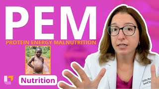 Protein Energy Malnutrition PEM Nursing School Nutrition Essentials Education  LevelUpRN [upl. by Atiran]