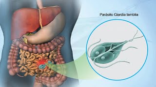 GIARDIA LAMBLIA  Etiología Clínica Diagnóstico y Tratamiento de Giardiasis  Parasitología 2023 [upl. by Cinimod]