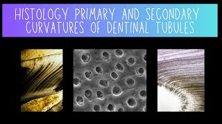 Histology of Primary and Secondary Dentinal Tubule Curvatures  Dentistry [upl. by Reta]