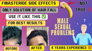 FINASTERIDE Side Effects RESULTS after 2 years use  Only SOLUTION of hairfall [upl. by Clementine]