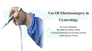 Electrosurgery in Gynaecology Part 3 MRCOG Stations [upl. by Palila27]