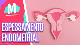 Conheça mitos e verdades sobre ESPESSAMENTO ENDOMETRIAL  Mulheres 061222 [upl. by Yaras532]