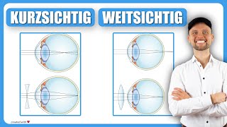 Kurzsichtig Myopie und Weitsichtig Hyperopie  Optik Auge [upl. by Amice412]