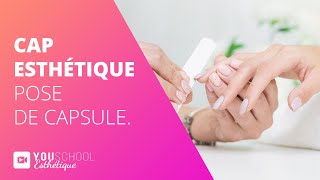 CAP Esthétique • Pose de capsule [upl. by Hterag]