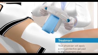 CRISTAL  Medical Cryolipolysis from France [upl. by Madonia]