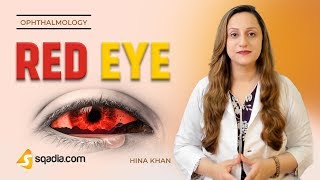 Red Eye  Episcleritis  Ophthalmology Video Lectures  Medical Education  VLearning [upl. by Polky]