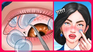 Removal of Contact Lenses Stuck Under the Eyelid👁️ Eye Infection Treatment ASMR [upl. by Nnylatsyrc527]