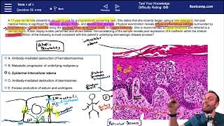 Real USMLE Step 1 Board Question Breakdown  Dermatology  Med School Bootcamp [upl. by Casar]