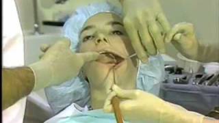 General Procedures in Oral Surgery [upl. by Leavy]