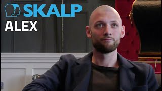 Alexs scalp micropigmentation testimonial with Skalp® [upl. by Calvina739]