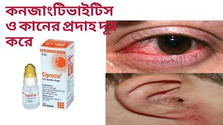 সিপ্রোসিন ড্রপের কাজ কি।Ciprocin eye drop। [upl. by Rosner]