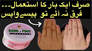 Cheek and chin Hand and Foot whitening creams Rang Gora Karen ka tarika [upl. by Alrats757]