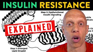 What Causes Insulin Resistance Unpacking the Effects of Excess Fat  Mastering Diabetes [upl. by Gillie]