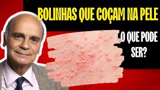 COCEIRA  De onde vem Como aliviar Por Luiz Gameiro dermatologista [upl. by Cath382]