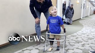 Paralympic medalist cheers toddler’s first steps with prosthetic leg  WNT [upl. by Nyliram]