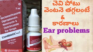 Ear pain chevi noppi treatment in allopathic in Telugu Ear pain Candibiotic drops [upl. by Phip]